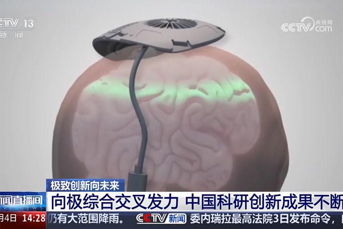 【新闻直播间】极致创新向未来 向极综合交叉发力 中国科研创新成果不断